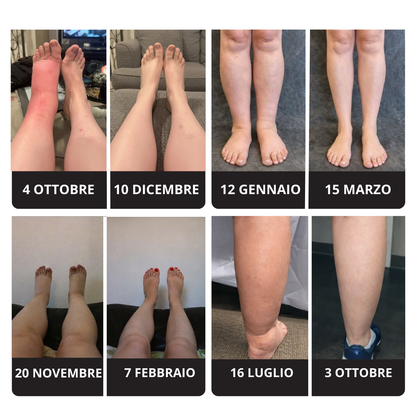 Calze a Compressione Graduata per Gambe Gonfie e Pesanti