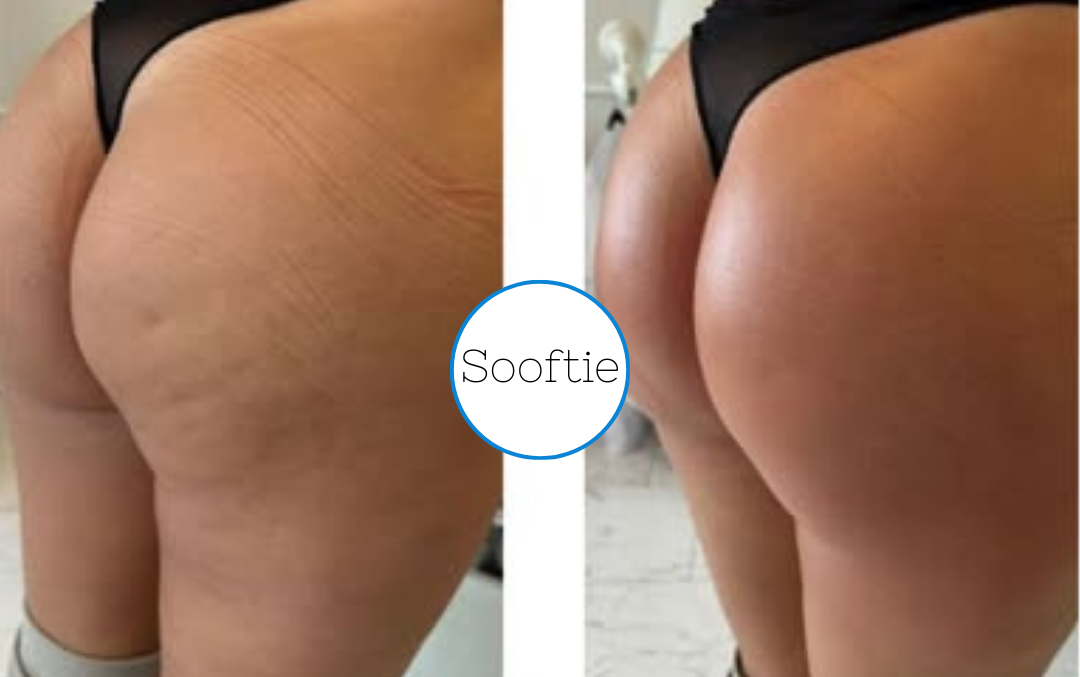 Prima e dopo